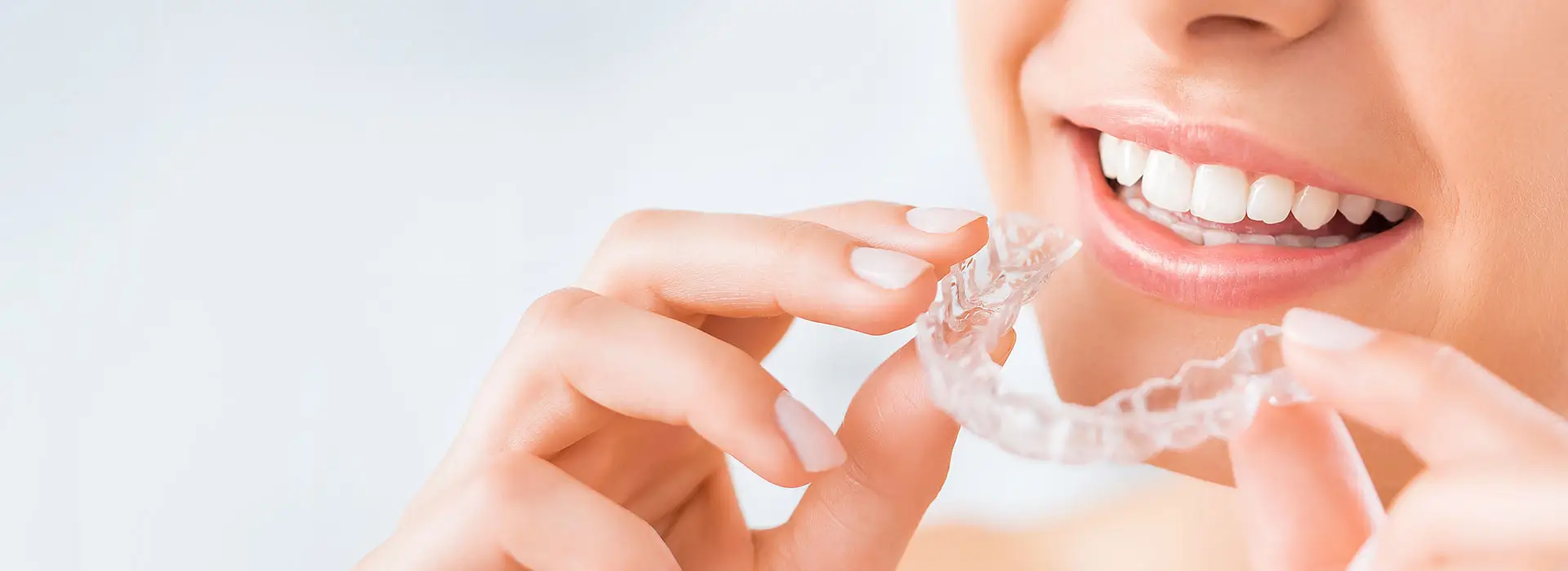 Invisalign treatment at 4 Square Dentistry Chennai