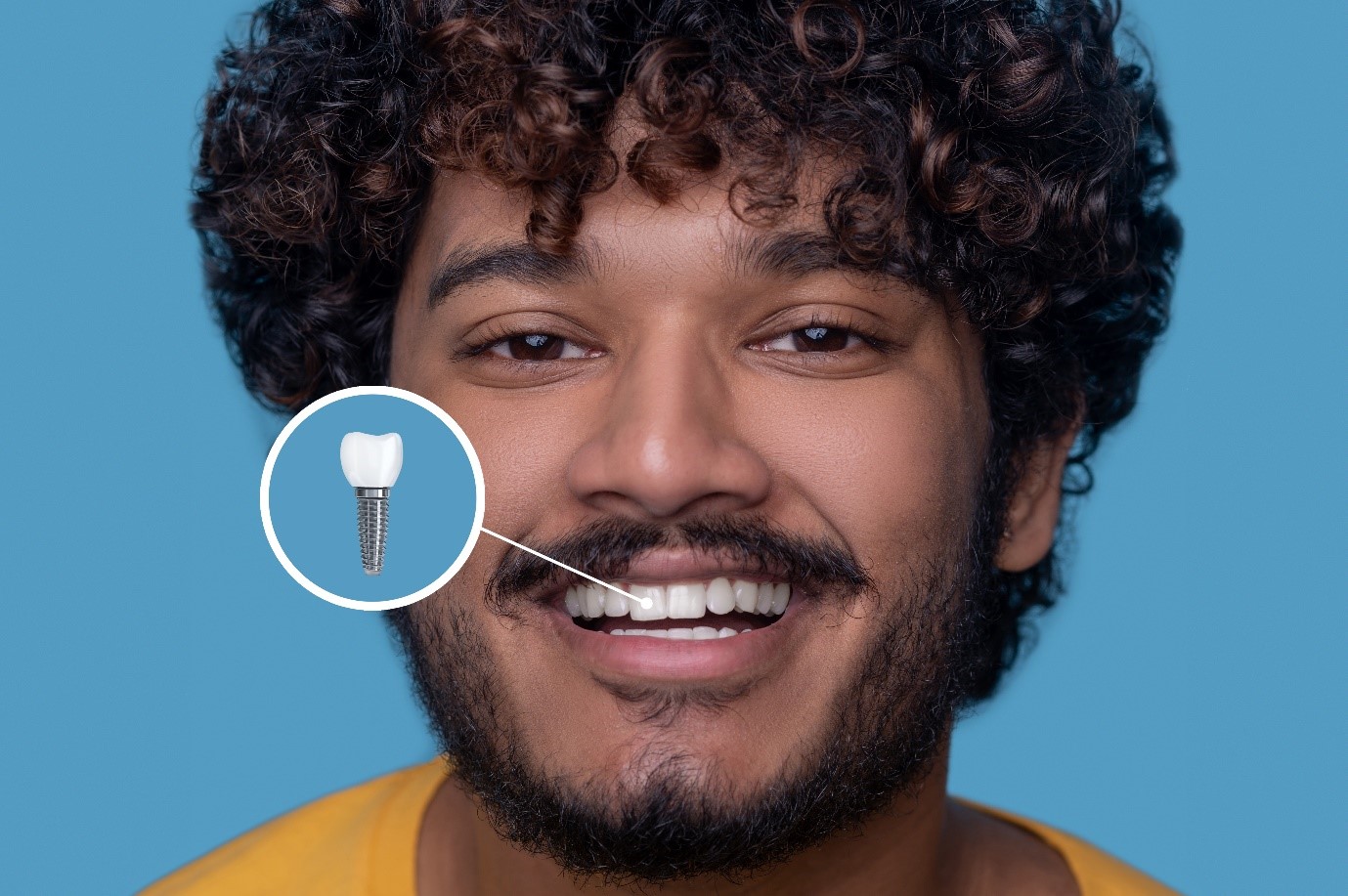 Smile Correction FAQs: Your Essential Guide to Transformative Smile Makeovers